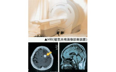 脳ドック コース | 中部国際医療センター M176S01